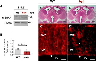 Alpha-SNAP (M105I) mutation promotes neuronal differentiation of neural stem/progenitor cells through overactivation of AMPK